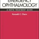 Exkluzív ajánlat Emergency Ophthalmology: A Rapid Treatment Guide byChern, Kenneth C;